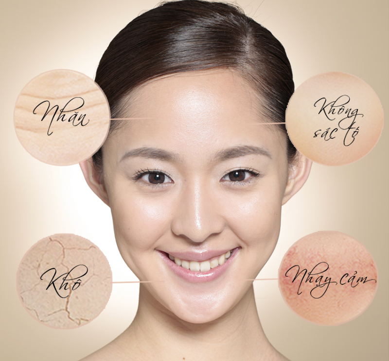 Da bạn thuộc loại da DSNW: Khô - Nhạy cảm - Không sắc tố - Nhăn
