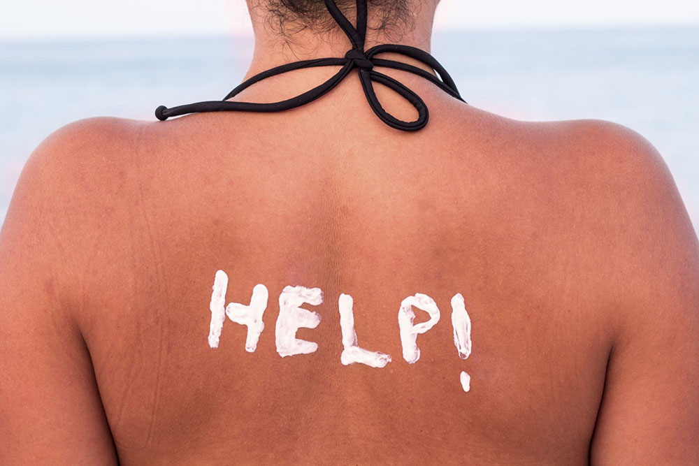 Tại sao da thường bị cháy nắng vào mùa hè và cách khắc phục?