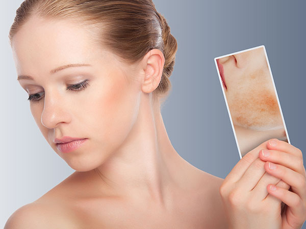 3 dấu hiệu cho thấy da bị hư tổn do dị ứng mỹ phẩm