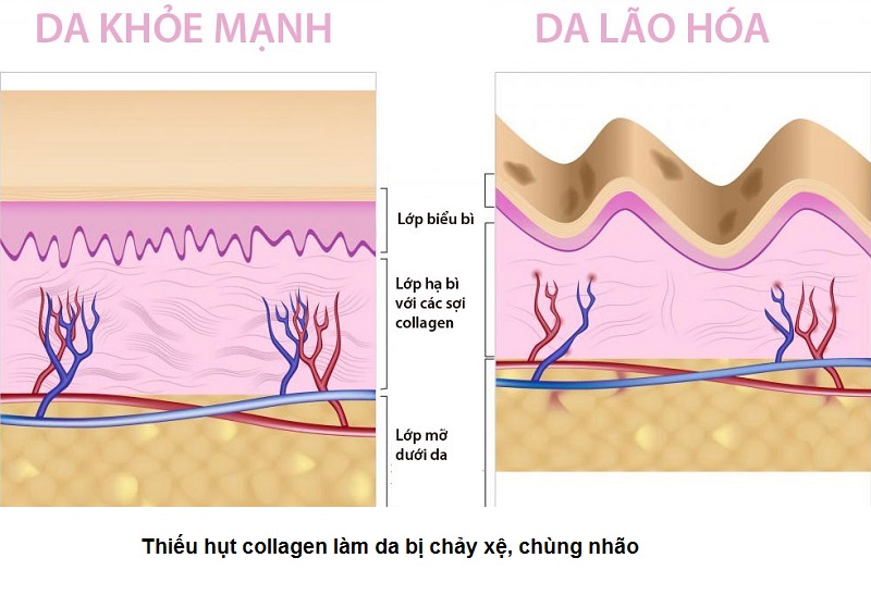 tai-sao-can-bo-sung-collagen