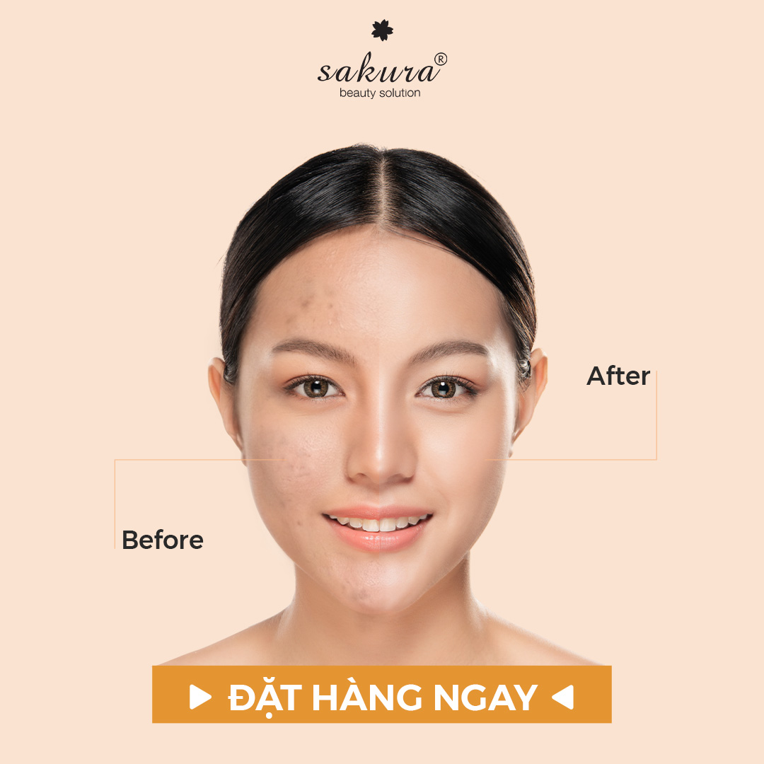 Kết cấu kem CC Sakura bản mới mỏng nhẹ khô thoáng không gây bít tắc lỗ chân lông